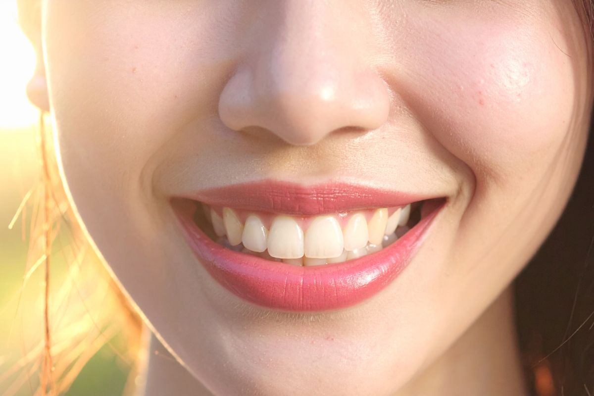 Smile Makeover