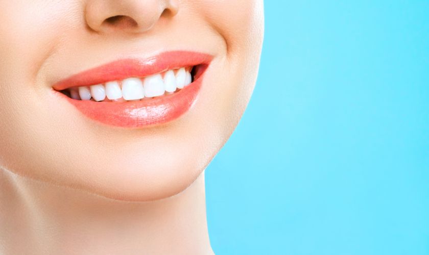 Teeth Whitening
