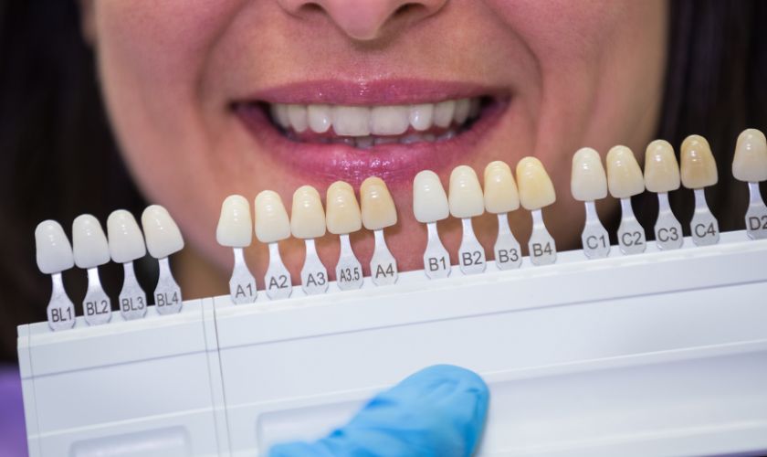 Porcelain Veneers in Newport News, Va