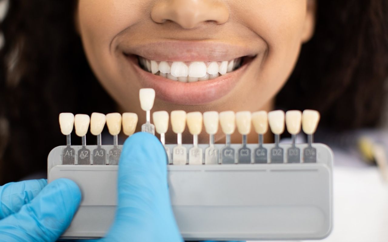 Do Veneers Require Special Care