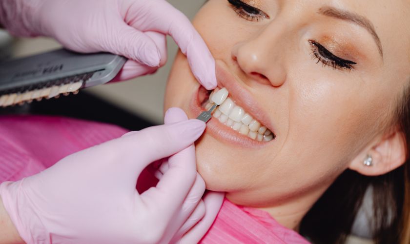Veneers Newport News