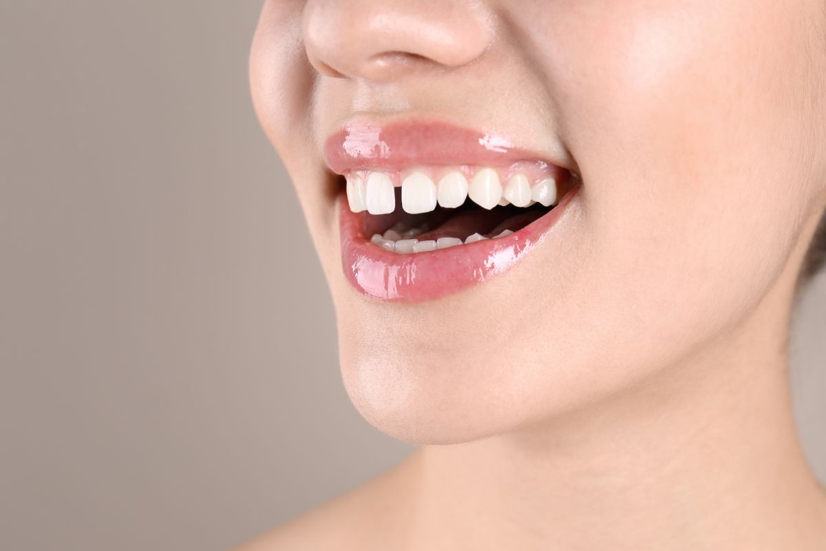 How To Reduce Gaps Between Teeth Naturally At Home