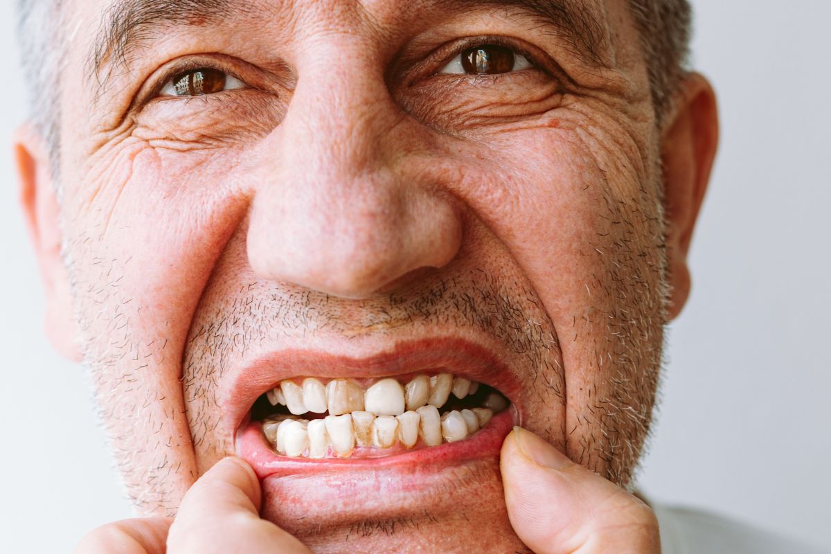 How to Remove Tartar From Teeth