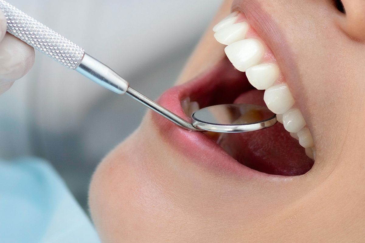 Choosing the Right Cosmetic Dental Treatment