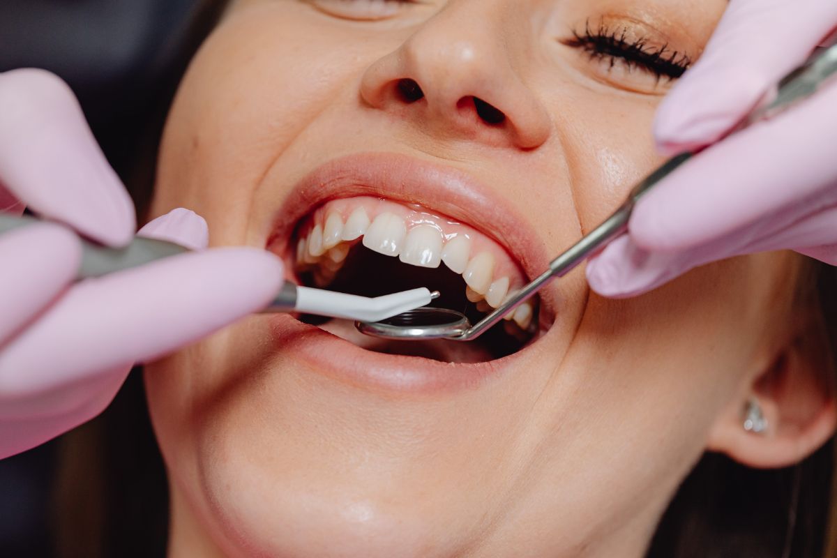 Common Cosmetic Dentistry Problems