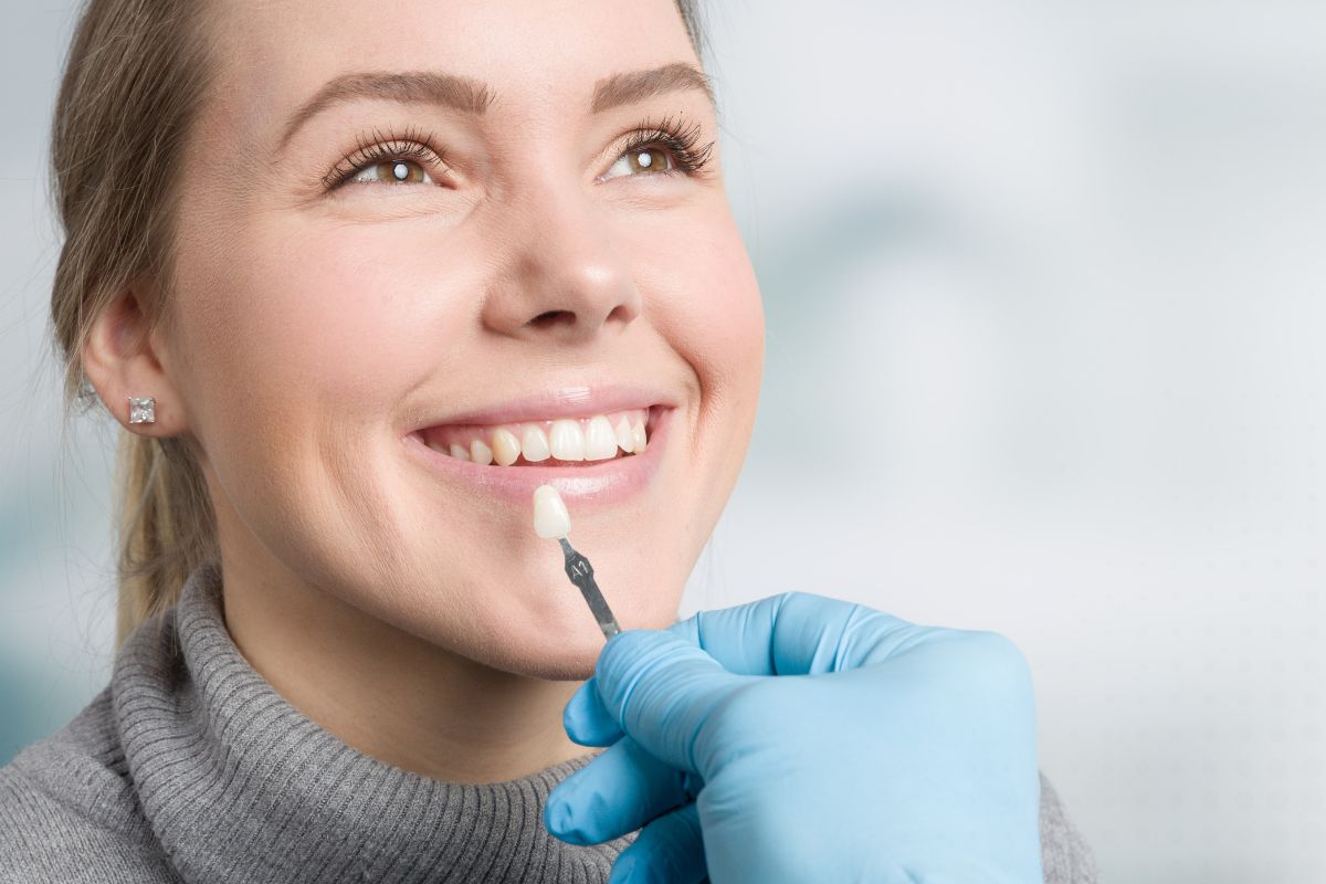 How to Care for Your Teeth After Getting Veneers