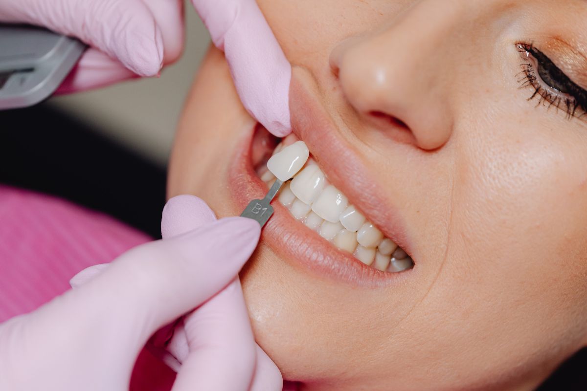 Things to Consider Before Starting Cosmetic Dental Treatment